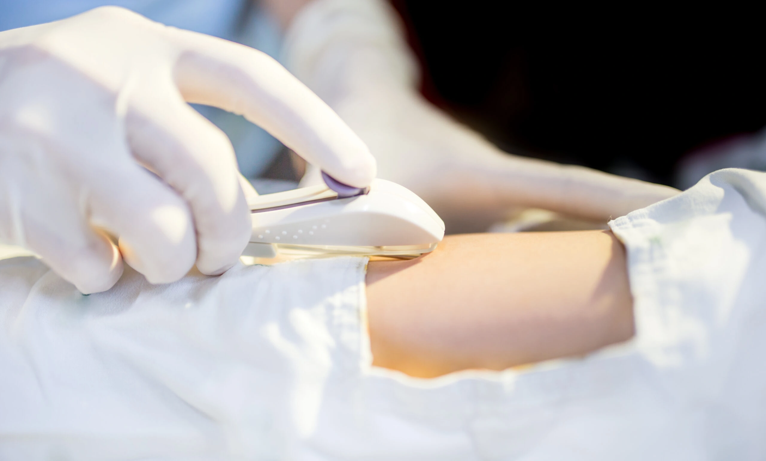 Implantes Hormonais